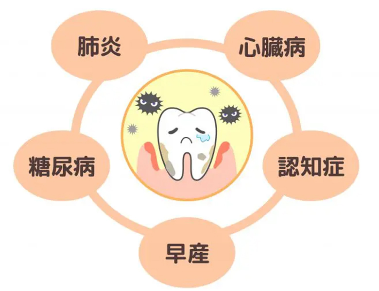 草加(草加市小山)の歯医者、市ノ澤歯科クリニックの歯周病治療